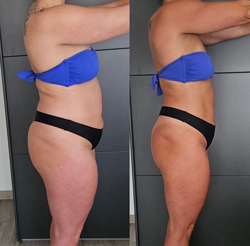 Transformation 1