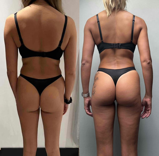 Transformation 2